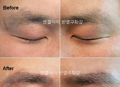 엔젤아이의원 이미지
