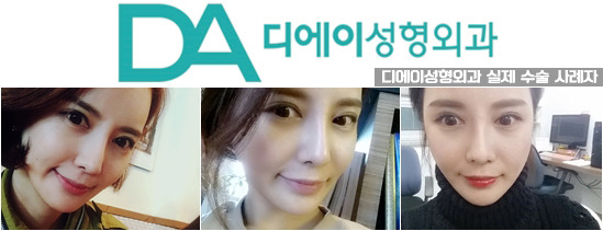 이미지성형외과 이미지