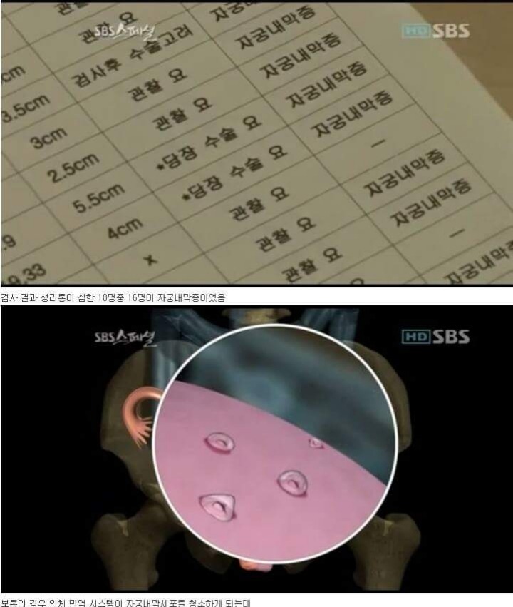 뿌쉈다 고쳤다 지잣대로하는 잣같은 생리통의 원인 | 인스티즈