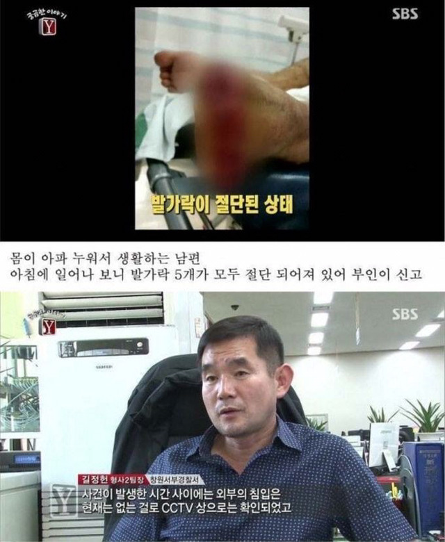자고 일어나니 발가락이 모두 사라진 남자 | 인스티즈