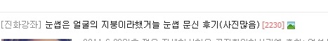 여성시대가 안죽는 이유 | 인스티즈