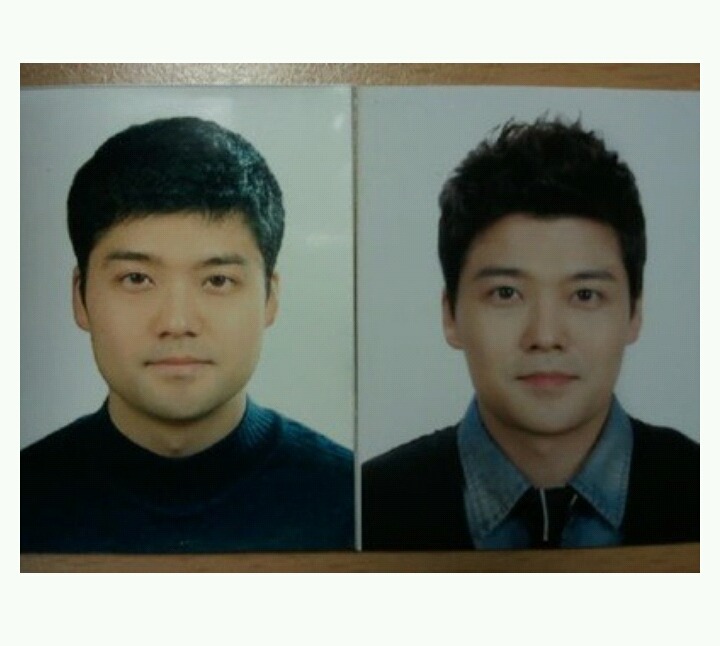 보톡스 효과.JPG | 인스티즈