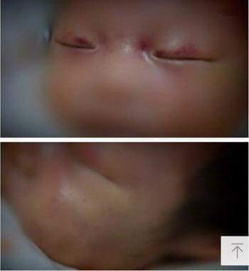 한번씩만 읽어주세요 생후 83일에 사망한 故박채린 양을 애도해주세요 | 인스티즈