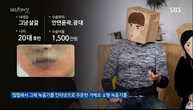 성형 수술 받은남자가 녹음한 의사들 잡담... | 인스티즈