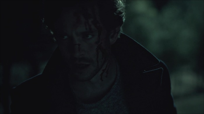 [로맨틱스릴러미드] 한니발 (Hannibal) 시즌3 에피5 (3/4) | 인스티즈