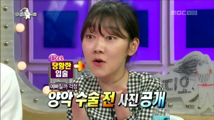 [라디오스타] 성형 사실 고백한 박경혜 | 인스티즈