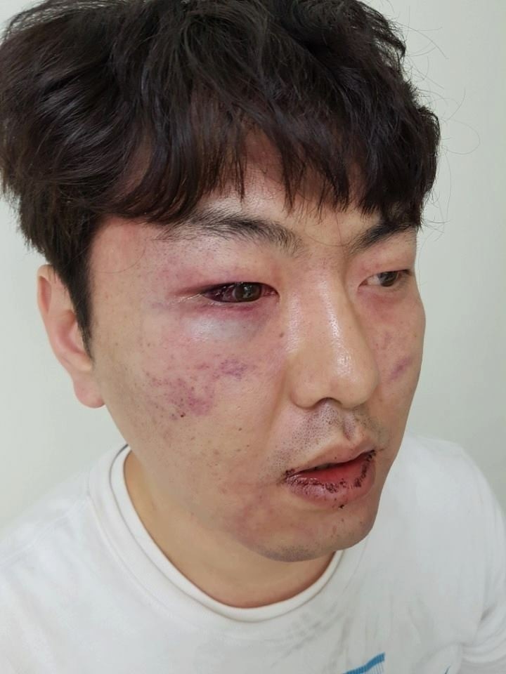 옥수역에서 경찰한테 폭행당한 남자 | 인스티즈