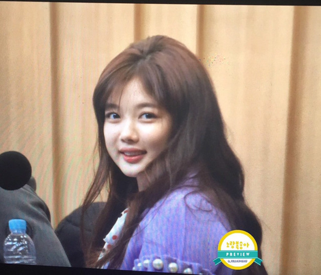 김유정 사랑니 뺐을때 얼굴 붓기 차이 | 인스티즈