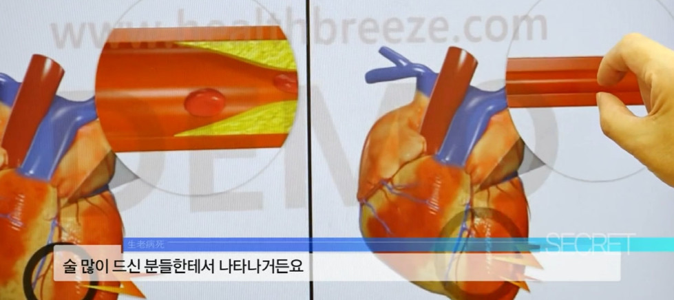 담배는 끊었지만 술의 유혹에서 벗어나지 못하는 58살 남성의 음주 습관 | 인스티즈