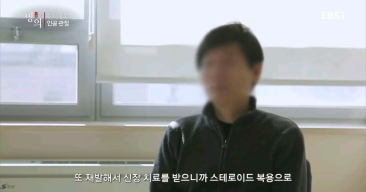 무서운 스테로이드 부작용.jpg | 인스티즈