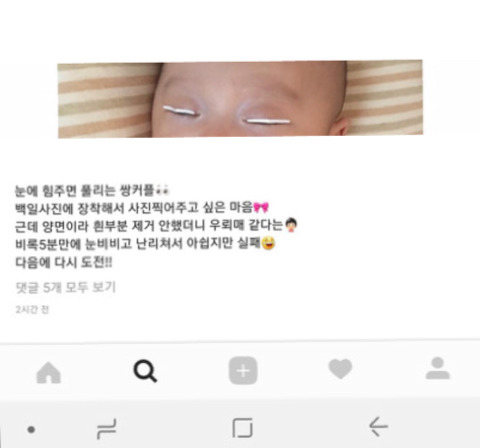 100일도 안된 아기한테 쌍테붙임 | 인스티즈
