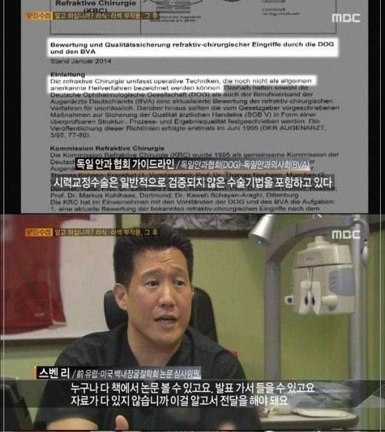 라식 라섹수술을 하면 안되는 이유....jpg | 인스티즈
