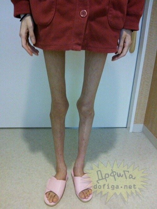 일본의 거식증녀 | 인스티즈