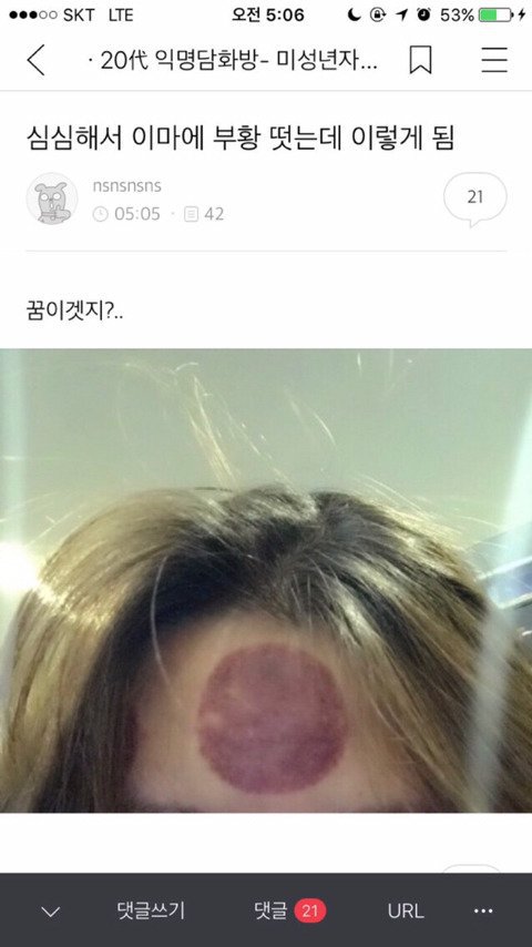 이마 이미지